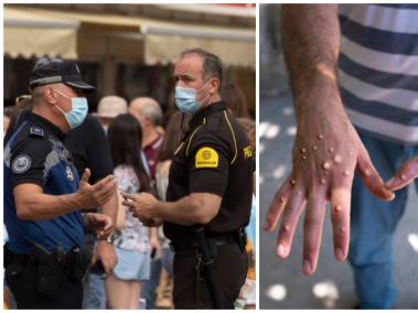 Policía española aconseja a sus agentes en la frontera usar mascarilla y guantes por viruela del mono.