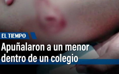 Se negó a prestarle el celular y terminó apuñalado. Una mamá denuncia que su hijo fue herido por un compañero de clases dentro del colegio. Por la lesión, el menor tuvo 8 días de incapacidad. En momentos, la historia completa y la respuesta de la secretaría de educación frente a este caso