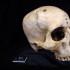 Se hallaron marcas de corte alrededor de lesiones en un cráneo que data de entre 2687 y 2345 a.C.
