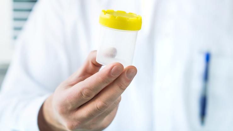 Doctor holding urine sample cup. Medical test in hospital.