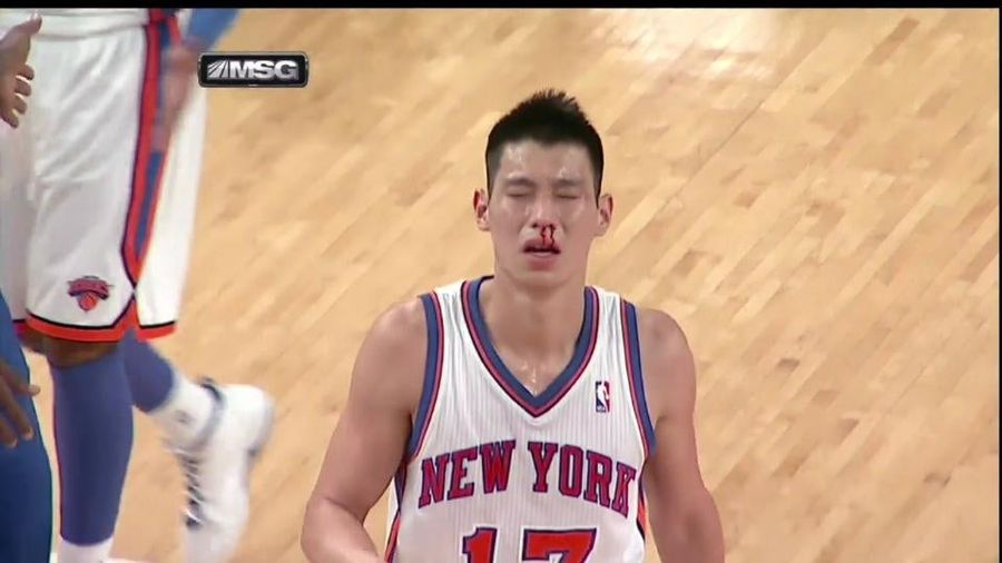 If You Foul Jeremy Lin, Does He Not Bleed?