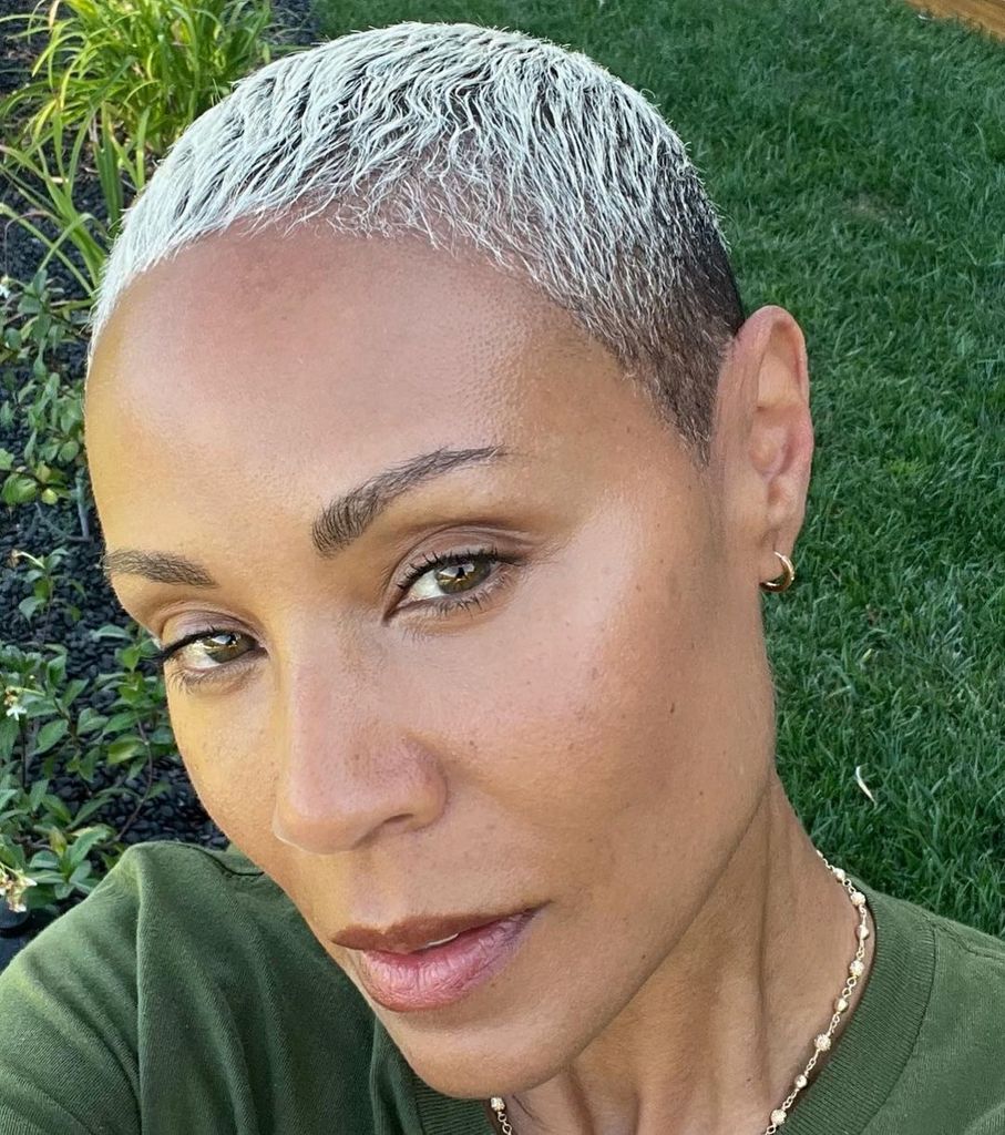 Jada Pinkett Smith hair regrowth 