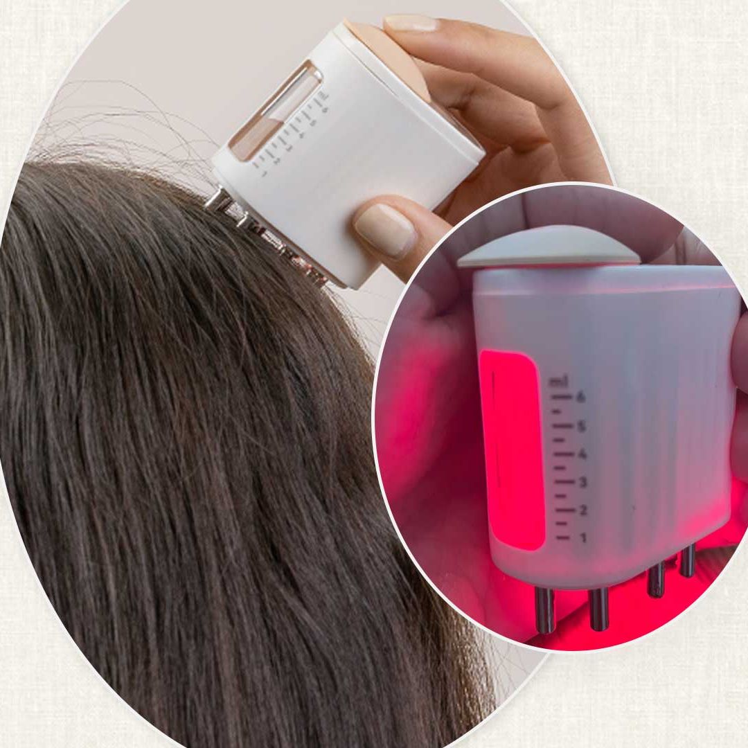 I’m 42 with thinning hair and credit Amazon’s LED Head Massager for slowing down hair loss - and it's now on sale