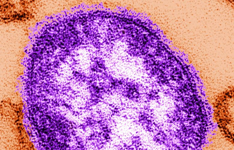 This undated image made available by the Centers for Disease Control and Prevention on Feb. 4, 2015, shows an electron microscope image of a measles virus particle, center. Measles is considered one of the most infectious diseases known. The virus is spread through the air when someone infected coughs or sneezes. (Courtesy of Centers for Disease Control and Prevention) 