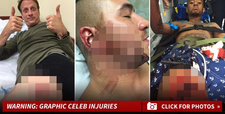 Gruesome Celebrity Injuries