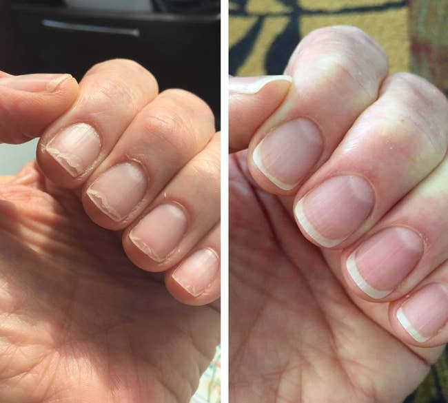 A split reviewer image showing a hand with brittle, chipped nails and dry cuticles on the left, and the same hand with healthy-looking nails and cuticle on the right 