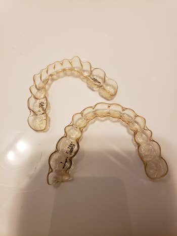 Reviewer's Invisalign, which look slightly yellow