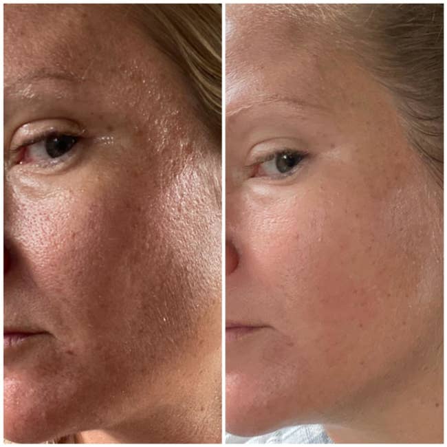 A reviewer's skin before and after use, with reduced texture