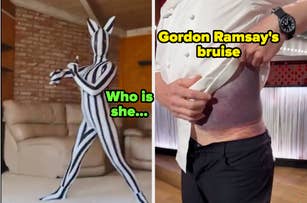 Left image: Person in a zebra body suit posing. Text reads, "Who is she...". Right image: Gordon Ramsay shows a large bruise on his side under lifted shirt