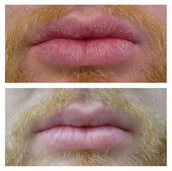 A reviewer's before/after showing healed cracks in their lips