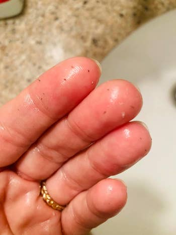 Close-up of a person's hand with tiny black dots on their fingertips