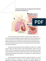 Pneumonia With Pleural Effusion