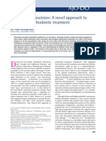 Sequential Piezocision A Novel Approach To Acelerated Orthodontic Treatment