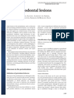 Acute Periodontal Lesions