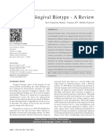 Gingival Biotype - A Review