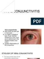 Viral Conjunctivitis