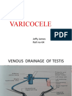 Varicocele