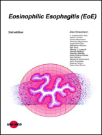 Eosinophilic Esophagitis (EoE)