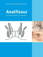 Analfissur: Symptome, Diagnose und Therapien