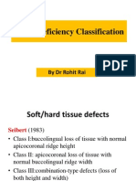 Alveolar Ridge