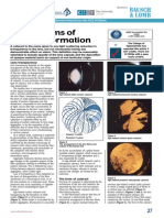 Mechanisms of Cataract Formation: Nicholas Phelps Brown MD, FRCS, Frcophth