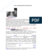 Interpretación de Las Radiografías de Abdomen en Urgencias