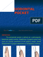 Peridontal Pocket Perio