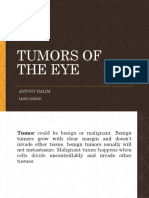 Tumors of The Eye: Antony Halim I4061162030