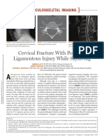 Cervical Fracture With Posterior Ligamentous Injury While Skydiving