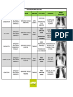 Síndromes Pleuropulmonares 2021