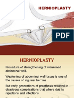 Hernioplasty