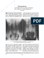 Hydronephrosis: A Radiologic Classification Based On Anatomical Variations!