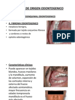 Tumores de Origen Odontogenico Expo