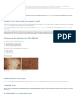 Tca Cross - Dermnet