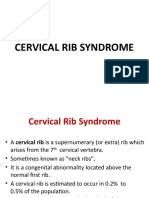 Cervical Rib