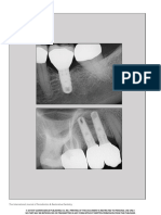 Randall 2019 - Implant Collar Design