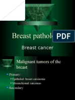 Breast Cancer