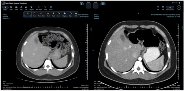 Descubra como a API Cloud Healthcare pode ser usada para armazenar, recuperar e analisar dados de imagens médicas