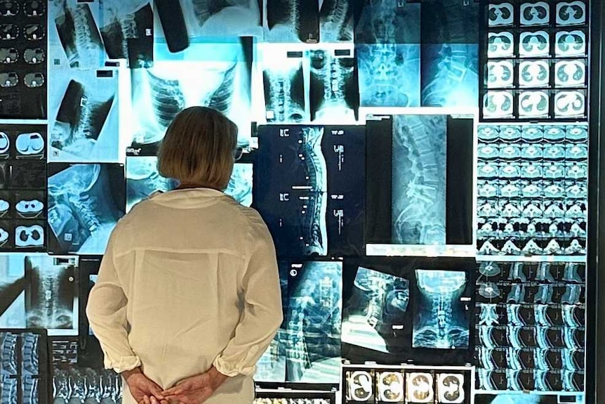 A woman stands at a high-rise office window, her back to the camera. The window is covered with x-rays.