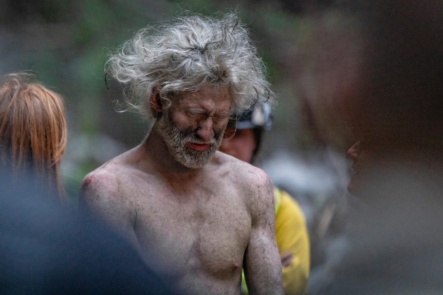 A shirtless man with white hair and a white beard is surrounded by a rescue team.