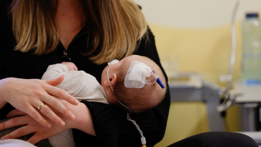 A woman holds a child with medical equipment taped to its head