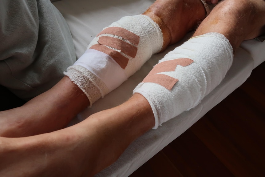 a pair of legs wrapped in bandages