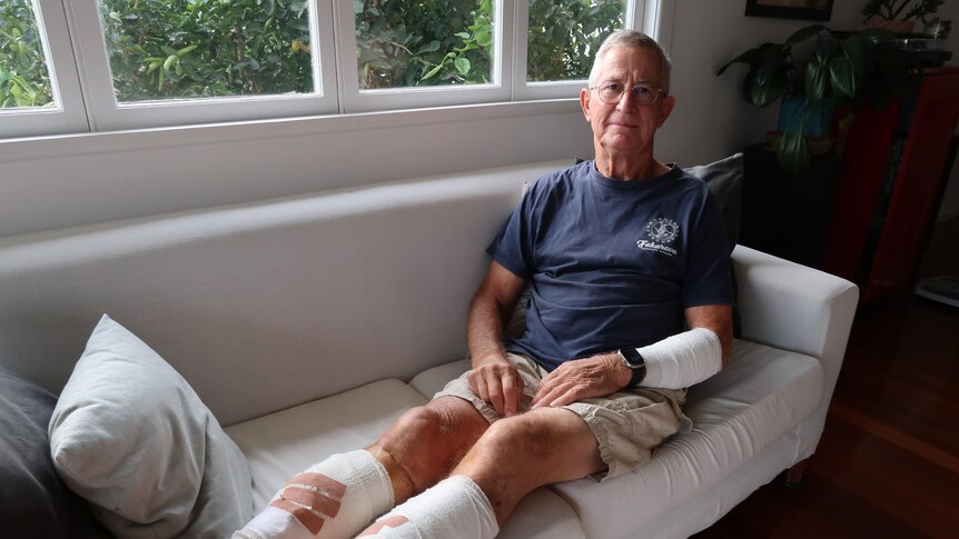 An older man sitting on a couch with his legs and one arm wrapped in bandages