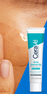 Acne Control Gel