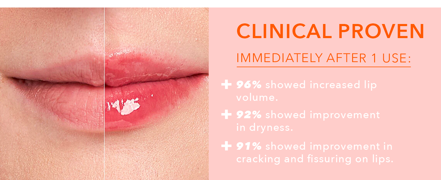  96% showed increased lip volume ​ 96% showed softer, smoother, more supple-looking lips