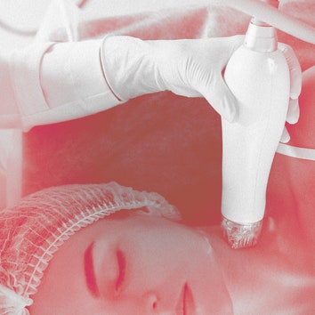 Is Radiofrequency Microneedling the Secret to Tighter Skin?