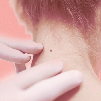 Here’s Exactly What to Expect at a Skin Cancer Check