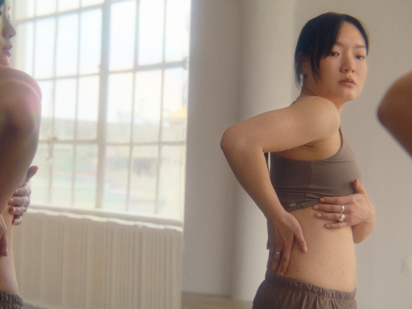 Why Dasol Kim Is Destigmatizing Psoriasis in the Dance Community