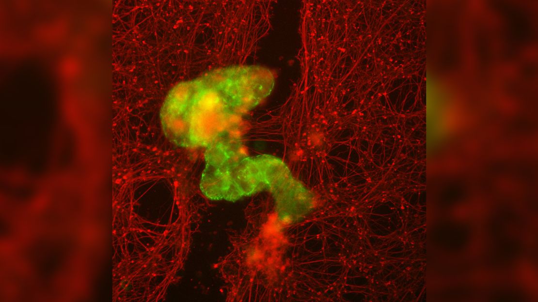 An anthrobot, in green, grows across a scratch through neuronal tissue, in red.