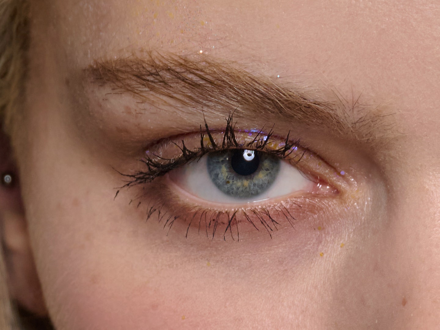 How to get rid of dark circles under the eyes, according to skin experts